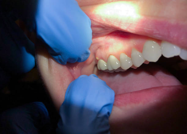 Dentist for Dental Trauma in CO